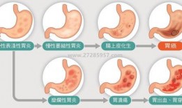 胃炎吃瓜和包米胃口疼,吃瓜与包米引发胃口疼痛