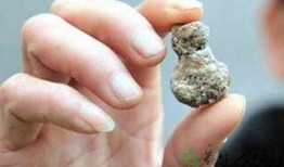 肾结石可以吃毛瓜