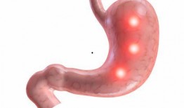 胃炎吃瓜和包米胃口疼,吃瓜与包米引发胃口疼痛