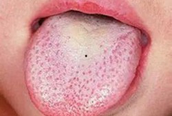 吃白瓜蛰舌头,一场味蕾与自然的邂逅