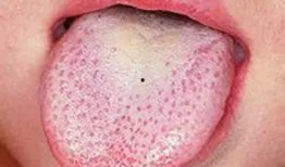 吃白瓜蛰舌头,一场味蕾与自然的邂逅